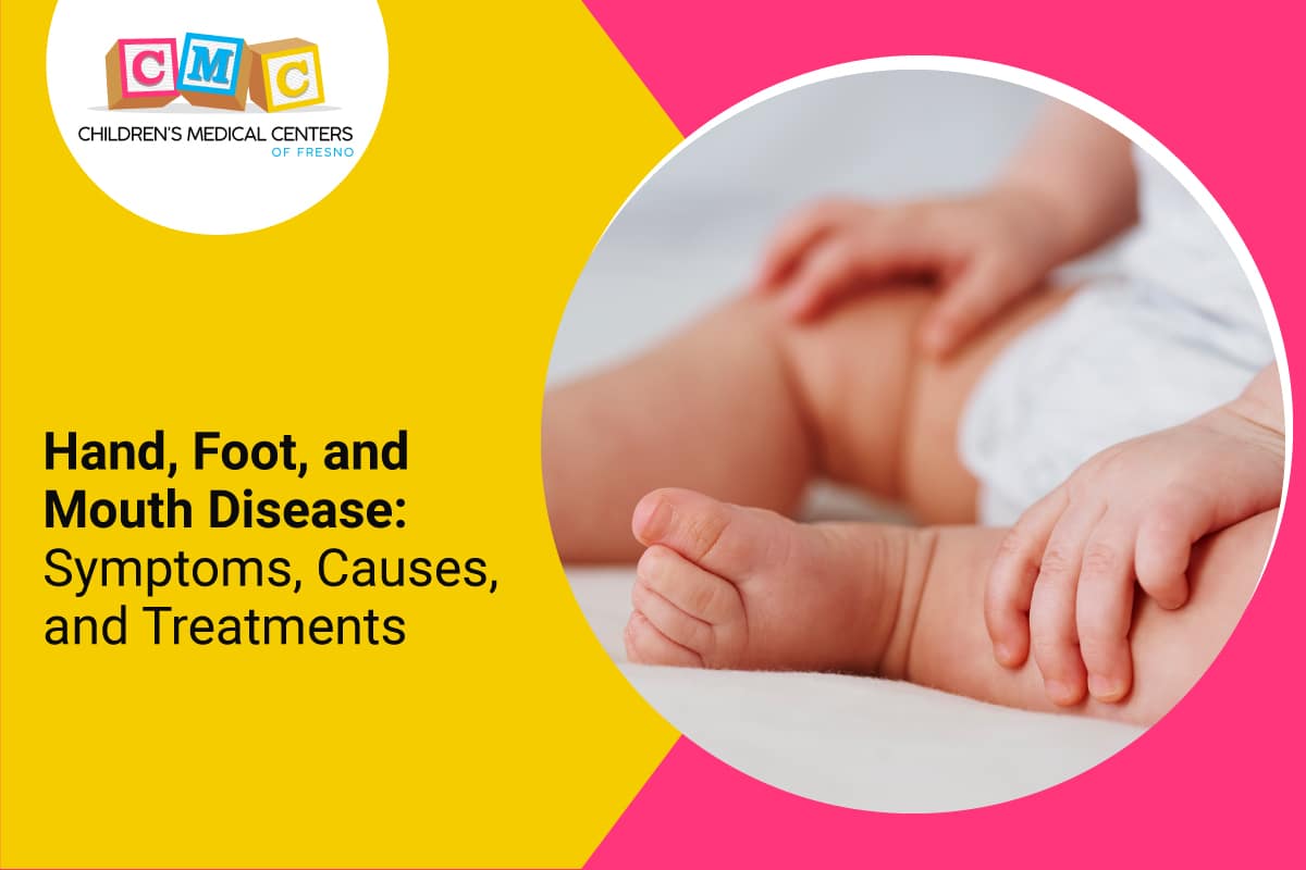 hand foot mouth disease