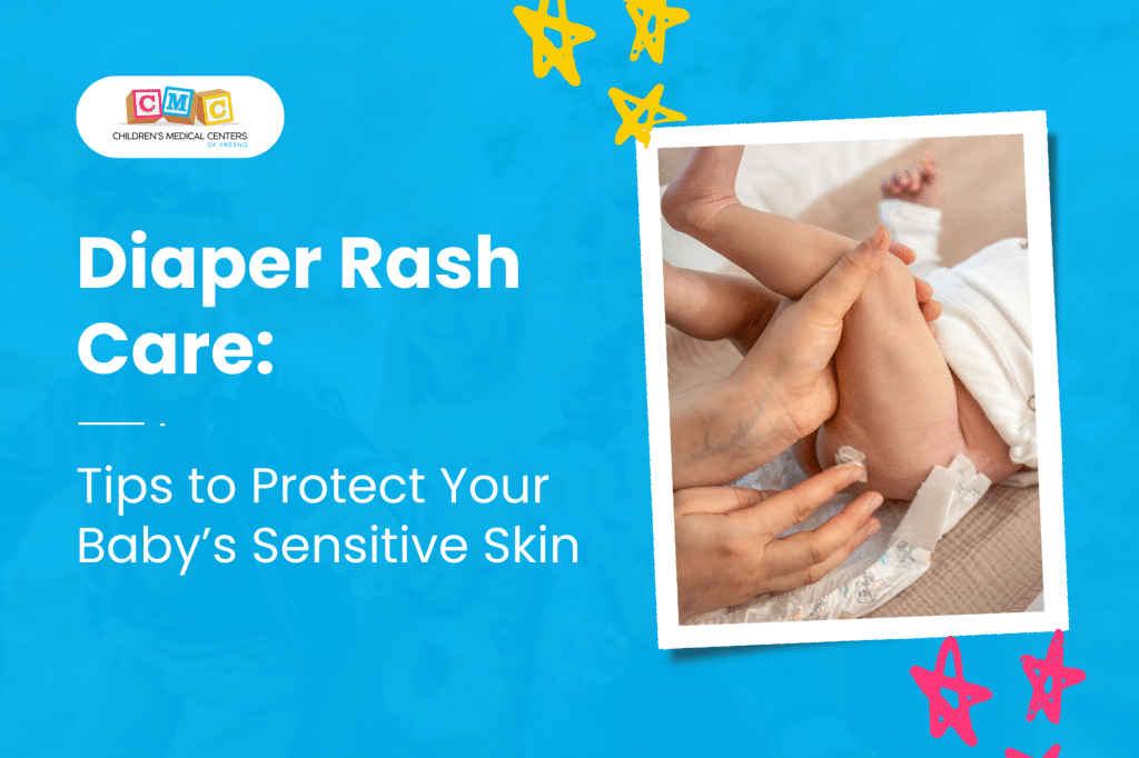 Diaper Rash Care: Tips to Protect Your Baby’s Sensitive Skin